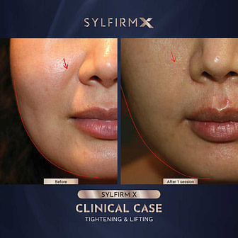 BA-WITHOUT-WATERMARKS-01