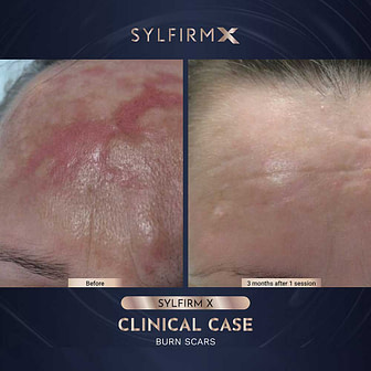 BA-WITHOUT-WATERMARKS-03