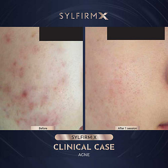 BA-WITHOUT-WATERMARKS-05