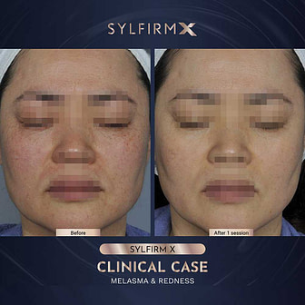 BA-WITHOUT-WATERMARKS-06