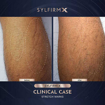 BA-WITHOUT-WATERMARKS-11