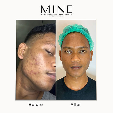 Foto-dan-template-BA-ibnu-2