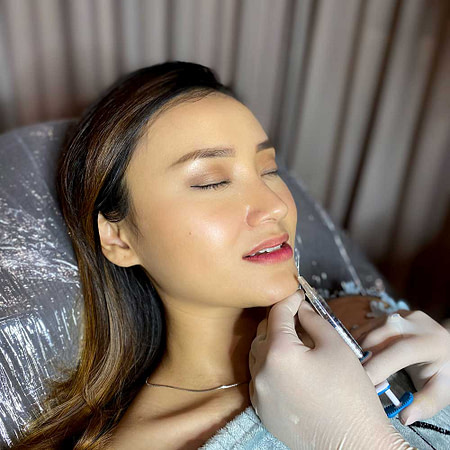 filler-bibir-mine-2