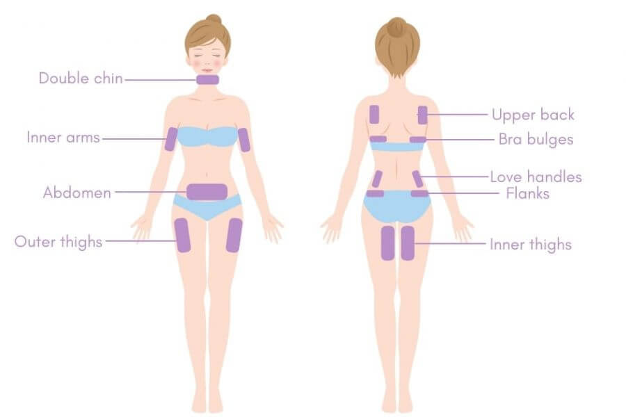 Fat-Freezing-dibawah-judul-Treatment-Areas