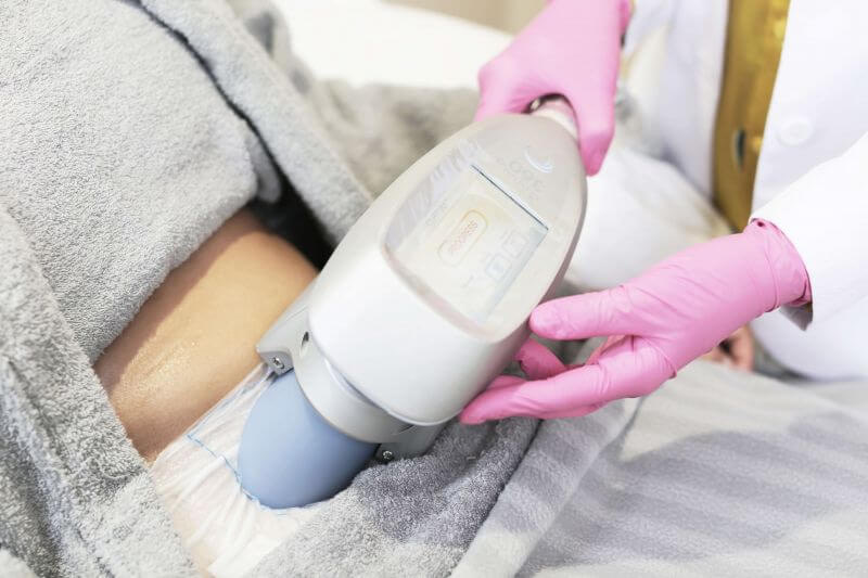 fat-freezing-1